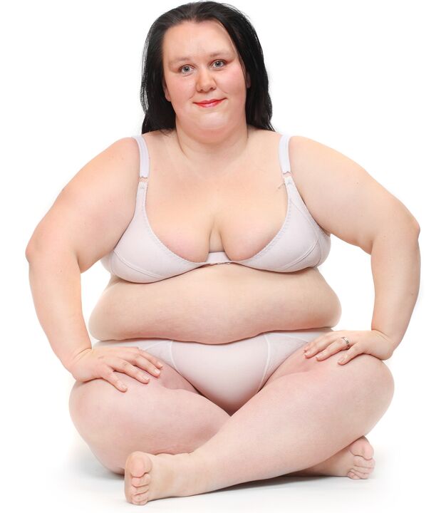 Femeie supraponderală